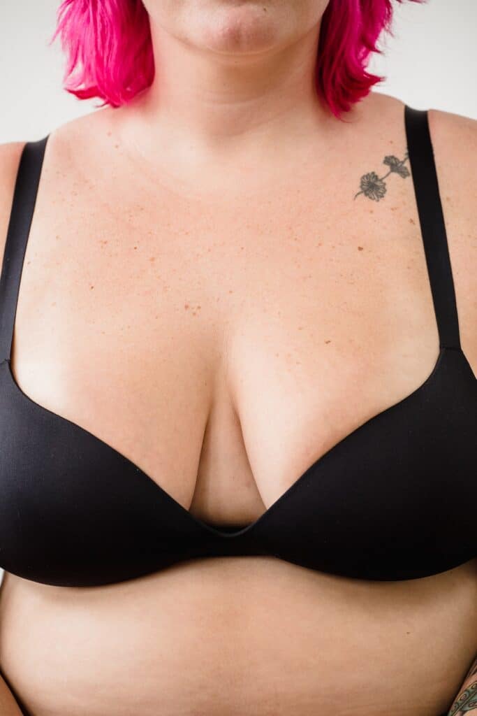 Brustverkleinerung Woman Wearing a Bra